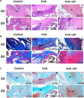 Injectable FHE+BP composites hydrogel with enhanced regenerative capacity of tendon-bone interface for anterior cruciate ligament reconstruction